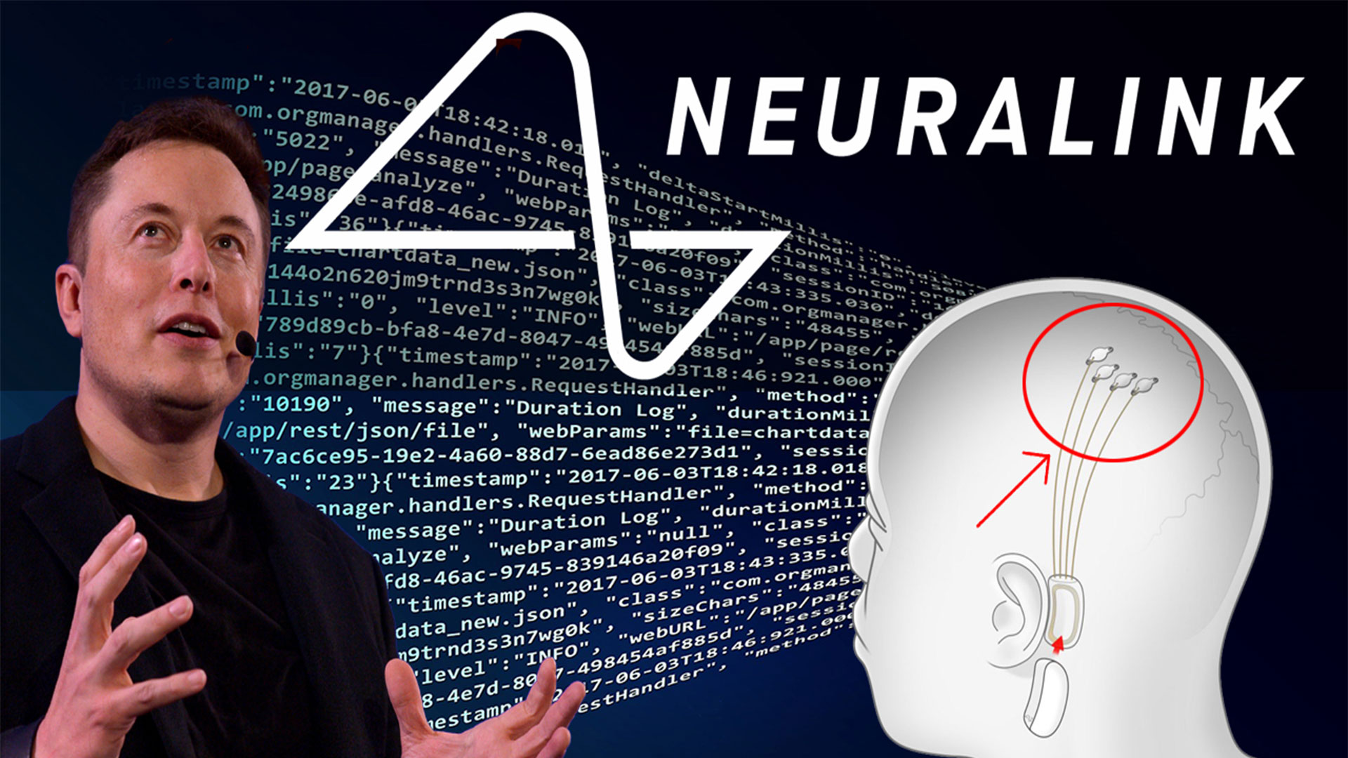 Neuralink-2